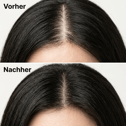 Korean Scalp Revival Bar